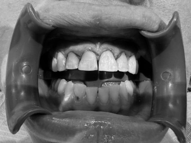 A Journey Toward Oral Health